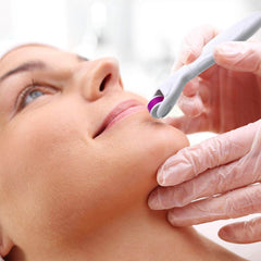 Derma Roller 4 In 1 Derma Roller