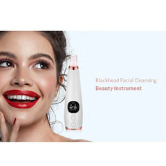 Black Head Remover Acne Cleansing High-pressure Suction - The Shopsite